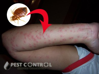 causes of bed bug